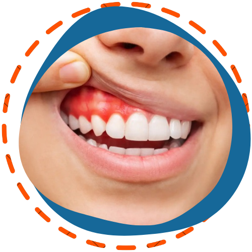 Periodoncia y encías sanas